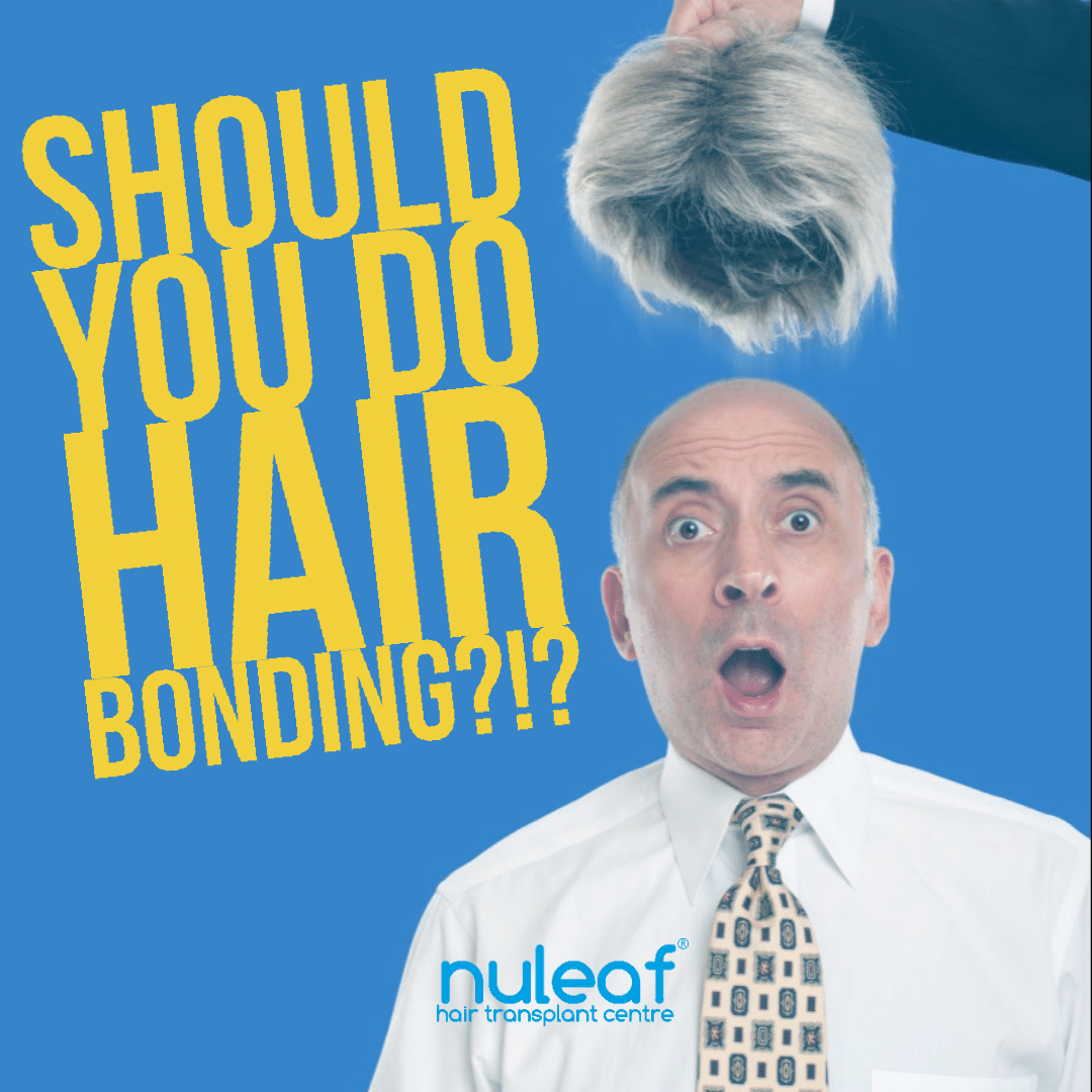 Hair Transplant or Hair Bonding? Know the difference